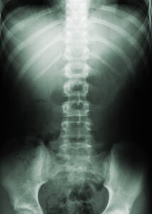 spine 2