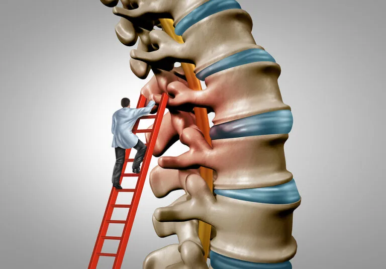 Symptoms of Spinal Stenosis