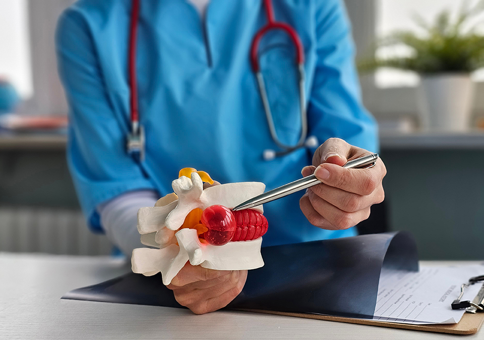 Lumbar Disc Herniation Lumbar Disc Herniation